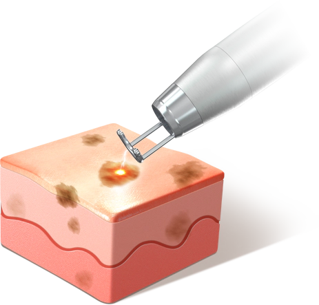 chrome 슬라이드 1번째