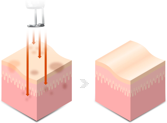 chrome 슬라이드 2번째