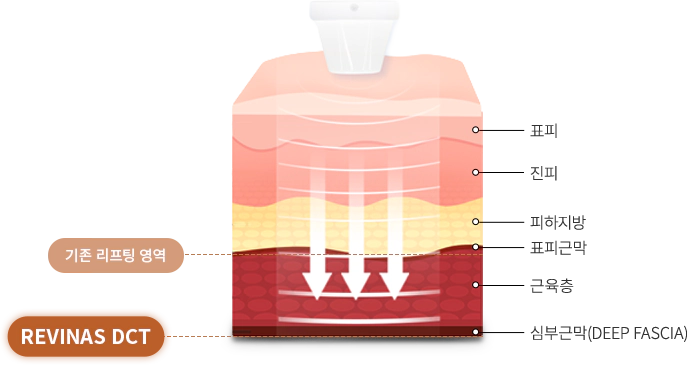 revinas 슬라이드 1번째