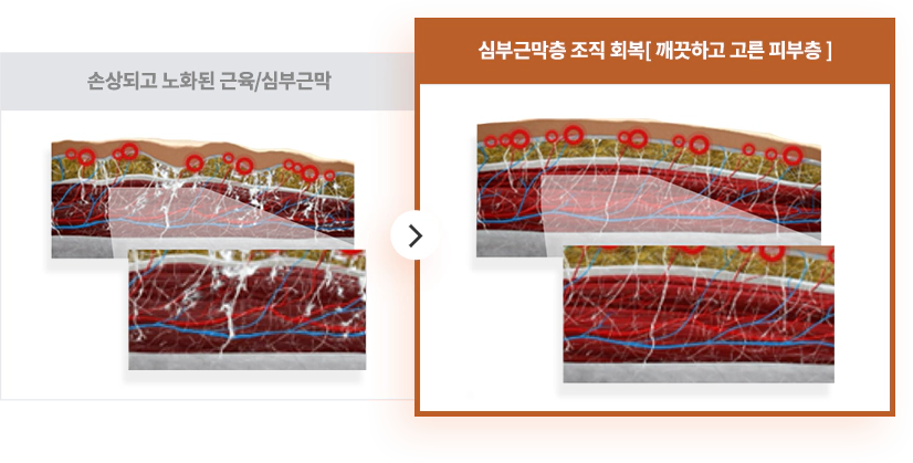 revinas 슬라이드 3번째