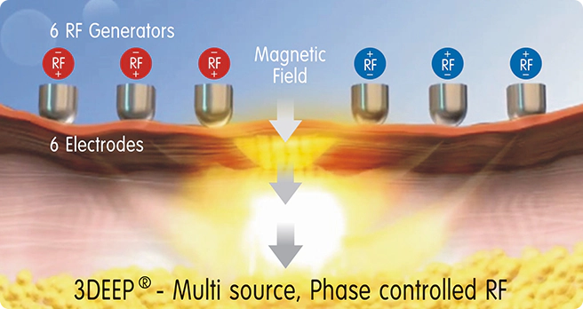 threedeep 슬라이드 1번째