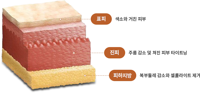 threedeep 슬라이드 2번째