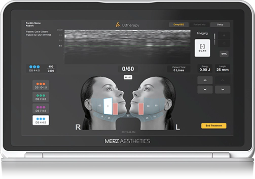 ultherapy 슬라이드 1번째